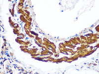 Immunohistochemistry of paraffin-embedded Rat lung using YTHDF2 Polyclonal Antibody at dilution of 1:100 (40x lens) .