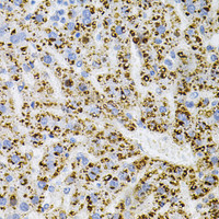 Immunohistochemistry of paraffin-embedded Rat liver using NTRK1 Polyclonal Antibody at dilution of 1:100 (40x lens) .