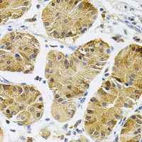 Immunohistochemistry of paraffin-embedded Human stomach using NTRK1 Polyclonal Antibody at dilution of 1:100 (40x lens) .