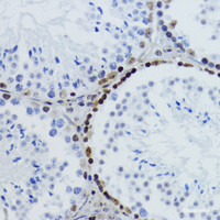 Immunohistochemistry of paraffin-embedded Mouse testis using Acetyl-Histone H2B-K12 Polyclonal Antibody at dilution of 1:200 (40x lens) .
