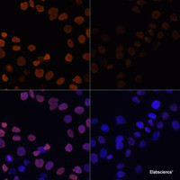 Immunofluorescence analysis of HeLa cells using Acetyl-Histone H2B-K12 Polyclonal Antibody at dilution of 1:100.HeLa cells were treated by TSA (1 uM) at 37℃ for 18 hours. Blue: DAPI for nuclear staining.