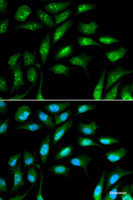 Immunofluorescence analysis of MCF-7 cells using beta 2 Microglobulin Polyclonal Antibody