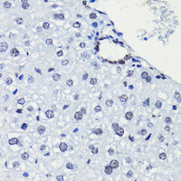 Immunohistochemistry of paraffin-embedded Mouse liver using Acetyl-Histone H2A-K5 Polyclonal Antibody at dilution of 1:100 (40x lens) .