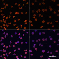 Immunofluorescence analysis of C6 cells using Acetyl-Histone H2A-K5 Polyclonal Antibody at dilution of 1:100.C6 cells were treated by TSA (1 uM) at 37℃ for 18 hours. Blue: DAPI for nuclear staining.