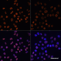 Immunofluorescence analysis of HeLa cells using Acetyl-Histone H2A-K5 Polyclonal Antibody at dilution of 1:100.HeLa cells were treated by TSA (1 uM) at 37℃ for 18 hours. Blue: DAPI for nuclear staining.