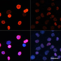 Immunofluorescence analysis of HeLa cells using Acetyl-Histone H2B-K5 Polyclonal Antibody at dilution of 1:100.HeLa cells were treated by TSA (1 uM) at 37℃ for 18 hours. Blue: DAPI for nuclear staining.