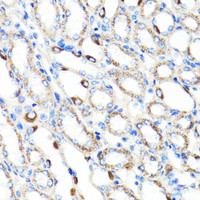 Immunohistochemistry of paraffin-embedded Mouse kidney using RNF149 Polyclonal Antibody at dilution of 1:100 (40x lens) .