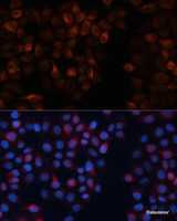 Immunofluorescence analysis of HeLa cells using CANX Polyclonal Antibody at dilution of 1:100. Blue: DAPI for nuclear staining.