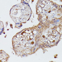 Immunohistochemistry of paraffin-embedded Human placenta using AGT Polyclonal Antibody at dilution of 1:100 (40x lens) .