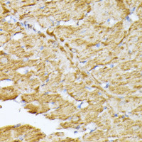 Immunohistochemistry of paraffin-embedded Rat heart using SLC25A5 Polyclonal Antibody at dilution of 1:100 (40x lens) .