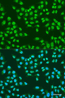 Immunofluorescence analysis of U2OS cells using ATM Polyclonal Antibody at dilution of 1:100. Blue: DAPI for nuclear staining.