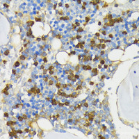 Immunohistochemistry of paraffin-embedded Rat bone marrow using CAMP Polyclonal Antibody at dilution of 1:200 (40x lens) .