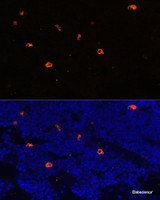 Immunofluorescence analysis of Rat bone marrow using CAMP Polyclonal Antibody at dilution of 1:100. Blue: DAPI for nuclear staining.