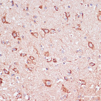 Immunohistochemistry of paraffin-embedded Mouse spinal cord using ENTPD6 Polyclonal Antibody at dilution of 1:100 (40x lens) .