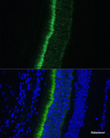 Immunofluorescence analysis of Mouse eye using GNGT1 Polyclonal Antibody at dilution of 1:100 (40x lens) . Blue: DAPI for nuclear staining.