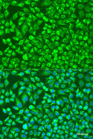 Immunofluorescence analysis of U2OS cells using MMP14 Polyclonal Antibody at dilution of 1:100. Blue: DAPI for nuclear staining.