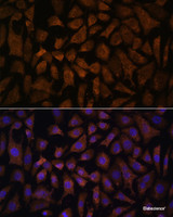 Immunofluorescence analysis of L929 cells using PPP2R5D Polyclonal Antibody at dilution of 1:100. Blue: DAPI for nuclear staining.