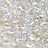 Immunohistochemistry of paraffin-embedded Rat liver using HP Polyclonal Antibody at dilution of 1:100 (40x lens) .