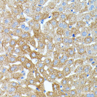 Immunohistochemistry of paraffin-embedded Mouse liver using HP Polyclonal Antibody at dilution of 1:100 (40x lens) .