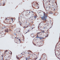 Immunohistochemistry of paraffin-embedded Human placenta using RPS13 Polyclonal Antibody at dilution of 1:100 (40x lens) .