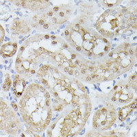 Immunohistochemistry of paraffin-embedded Rat kidney using TPI1 Polyclonal Antibody at dilution of 1:100 (40x lens) .