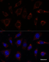 Immunofluorescence analysis of L929 cells using TBRG4 Polyclonal Antibody at dilution of 1:100. Blue: DAPI for nuclear staining.