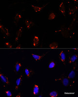 Immunofluorescence analysis of U-2 OS cells using TBRG4 Polyclonal Antibody at dilution of 1:100. Blue: DAPI for nuclear staining.