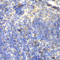 Immunohistochemistry of paraffin-embedded Mouse spleen using BTK Polyclonal Antibody at dilution of 1:100 (40x lens) .