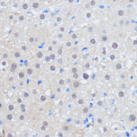 Immunohistochemistry of paraffin-embedded Rat liver using RBM39 Polyclonal Antibody at dilution of 1:100 (40x lens) .