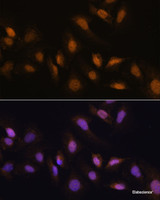 Immunofluorescence analysis of U-2 OS cells using RBM39 Polyclonal Antibody at dilution of 1:100. Blue: DAPI for nuclear staining.