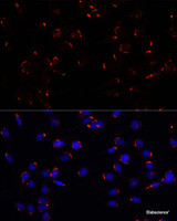 Immunofluorescence analysis of C6 cells using GOLGA5 Polyclonal Antibody at dilution of 1:100. Blue: DAPI for nuclear staining.