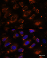 Immunofluorescence analysis of U-2 OS cells using TENM1 Polyclonal Antibody at dilution of 1:100. Blue: DAPI for nuclear staining.