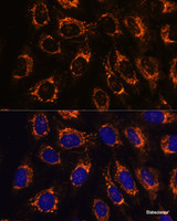 Immunofluorescence analysis of U-2 OS cells using ACAA2 Polyclonal Antibody at dilution of 1:100. Blue: DAPI for nuclear staining.