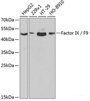 Western blot analysis of extracts of various cell lines using Factor IX / F9 Polyclonal Antibody at dilution of 1:1000.
