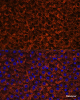 Immunofluorescence analysis of Rat liver using Factor IX / F9 Polyclonal Antibody at dilution of 1:100 (40x lens) . Blue: DAPI for nuclear staining.