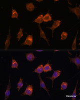 Immunofluorescence analysis of L929 cells using AVIL Polyclonal Antibody at dilution of 1:100. Blue: DAPI for nuclear staining.