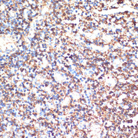 Immunohistochemistry of paraffin-embedded Human tonsil using HLA-DRA Polyclonal Antibody at dilution of 1:100 (40x lens) .