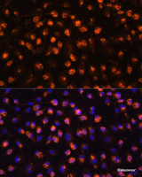 Immunofluorescence analysis of RAW264.7 cells using CD11B Polyclonal Antibody at dilution of 1:100. Blue: DAPI for nuclear staining.