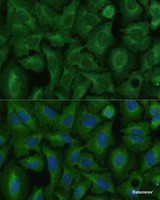 Immunofluorescence analysis of U-2 OS cells using TIMM8B Polyclonal Antibody at dilution of 1:100 (40x lens) . Blue: DAPI for nuclear staining.