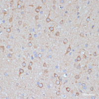 Immunohistochemistry of paraffin-embedded Rat brain using COPG2 Polyclonal Antibody at dilution of 1:100 (40x lens) .