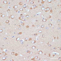 Immunohistochemistry of paraffin-embedded Mouse brain using COPG2 Polyclonal Antibody at dilution of 1:100 (40x lens) .