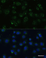 Immunofluorescence analysis of C6 cells using COPG2 Polyclonal Antibody at dilution of 1:100 (40x lens) . Blue: DAPI for nuclear staining.