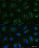Immunofluorescence analysis of U-2 OS cells using COPG2 Polyclonal Antibody at dilution of 1:100 (40x lens) . Blue: DAPI for nuclear staining.