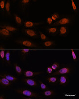 Immunofluorescence analysis of U-2 OS cells using THRB Polyclonal Antibody at dilution of 1:100. Blue: DAPI for nuclear staining.