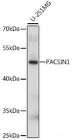 Western blot analysis of extracts of U-251MG cells using PACSIN1 Polyclonal Antibody at dilution of 1:1000.