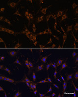Immunofluorescence analysis of C6 cells using UBE2J1 Polyclonal Antibody at dilution of 1:100. Blue: DAPI for nuclear staining.