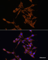 Immunofluorescence analysis of HeLa cells using UBE2J1 Polyclonal Antibody at dilution of 1:100. Blue: DAPI for nuclear staining.