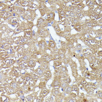 Immunohistochemistry of paraffin-embedded Rat liver using CDK5RAP1 Polyclonal Antibody at dilution of 1:100 (40x lens) .