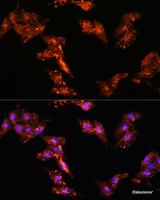 Immunofluorescence analysis of HeLa cells using CDK5RAP1 Polyclonal Antibody at dilution of 1:100. Blue: DAPI for nuclear staining.