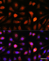 Immunofluorescence analysis of L-929 cells using CDK5RAP1 Polyclonal Antibody at dilution of 1:100. Blue: DAPI for nuclear staining.